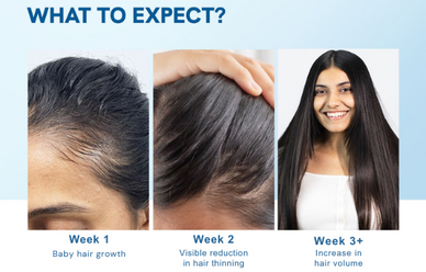 "Revitalize Your Confidence with Lush, Thick Locks"